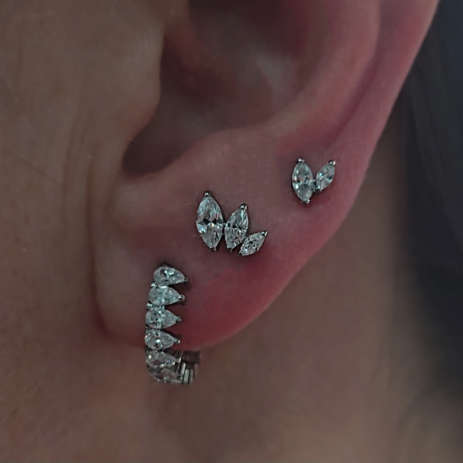 clicker ring zirconia titanio lobo