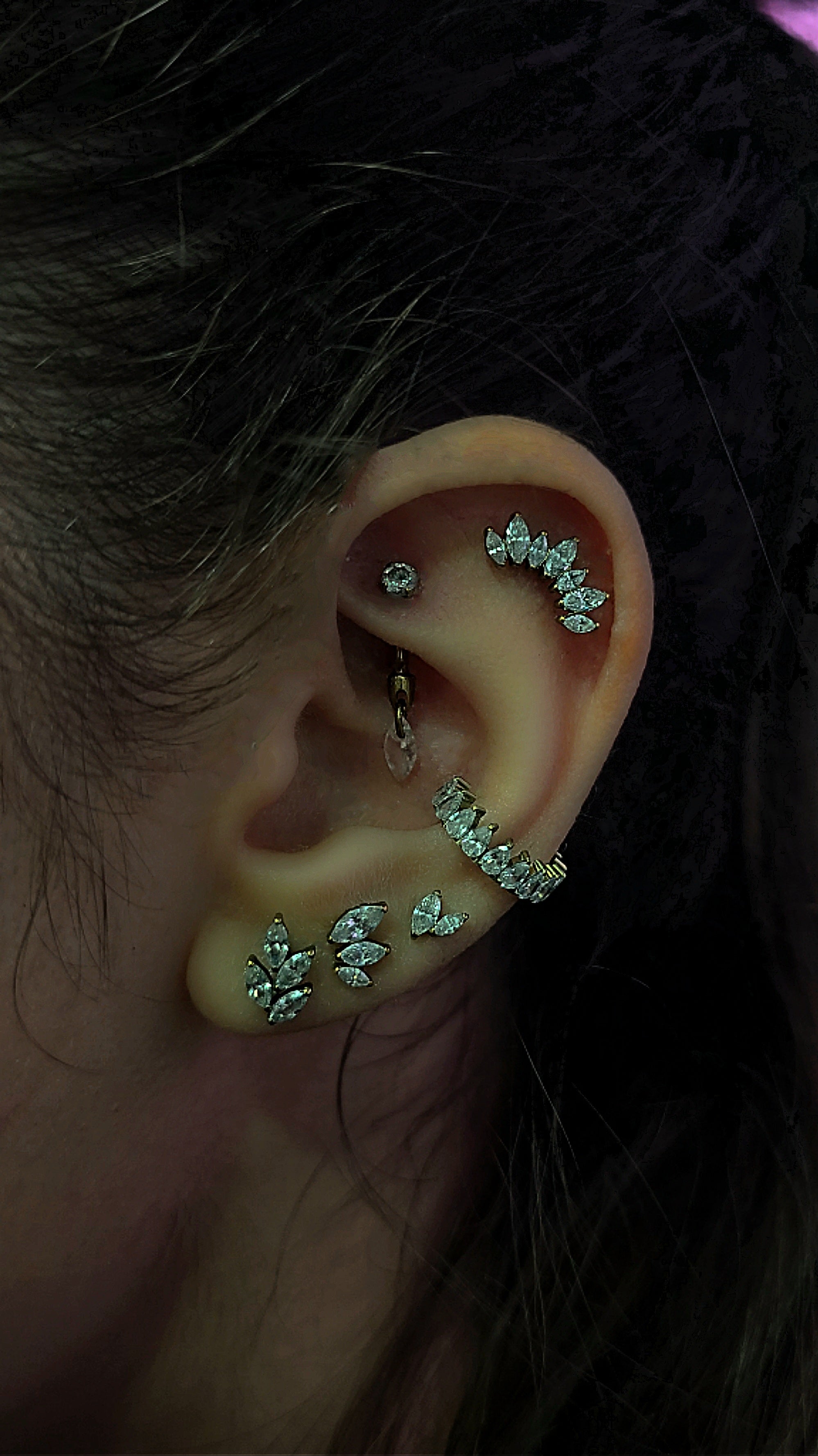 clicker ring zirconia titanio orecchio